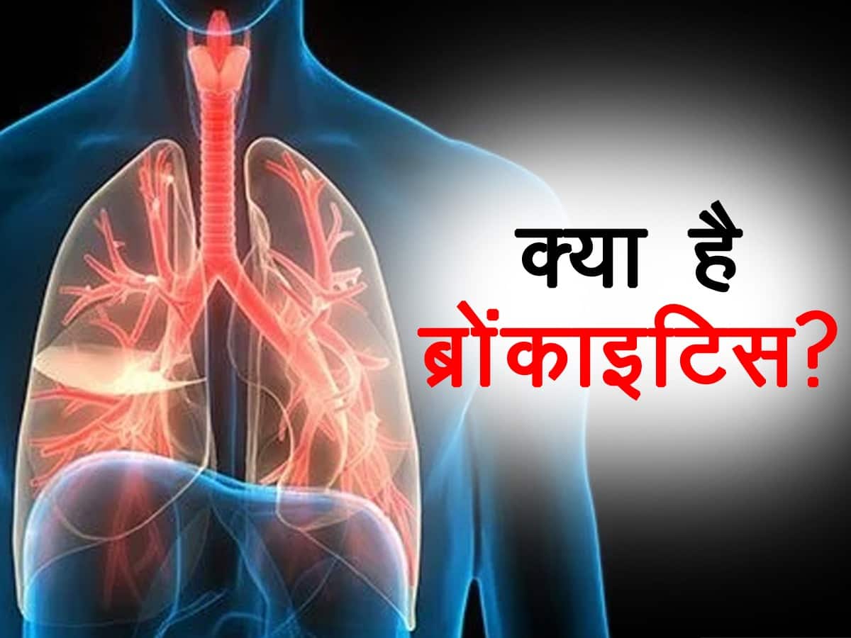 Bronchitis symptoms in hindi : ज्यादा खांसी सिर्फ टीबी नहीं! हो सकती है ये गंभीर बीमारी, जानें बीमारी के लक्षण, कारण और उपचार